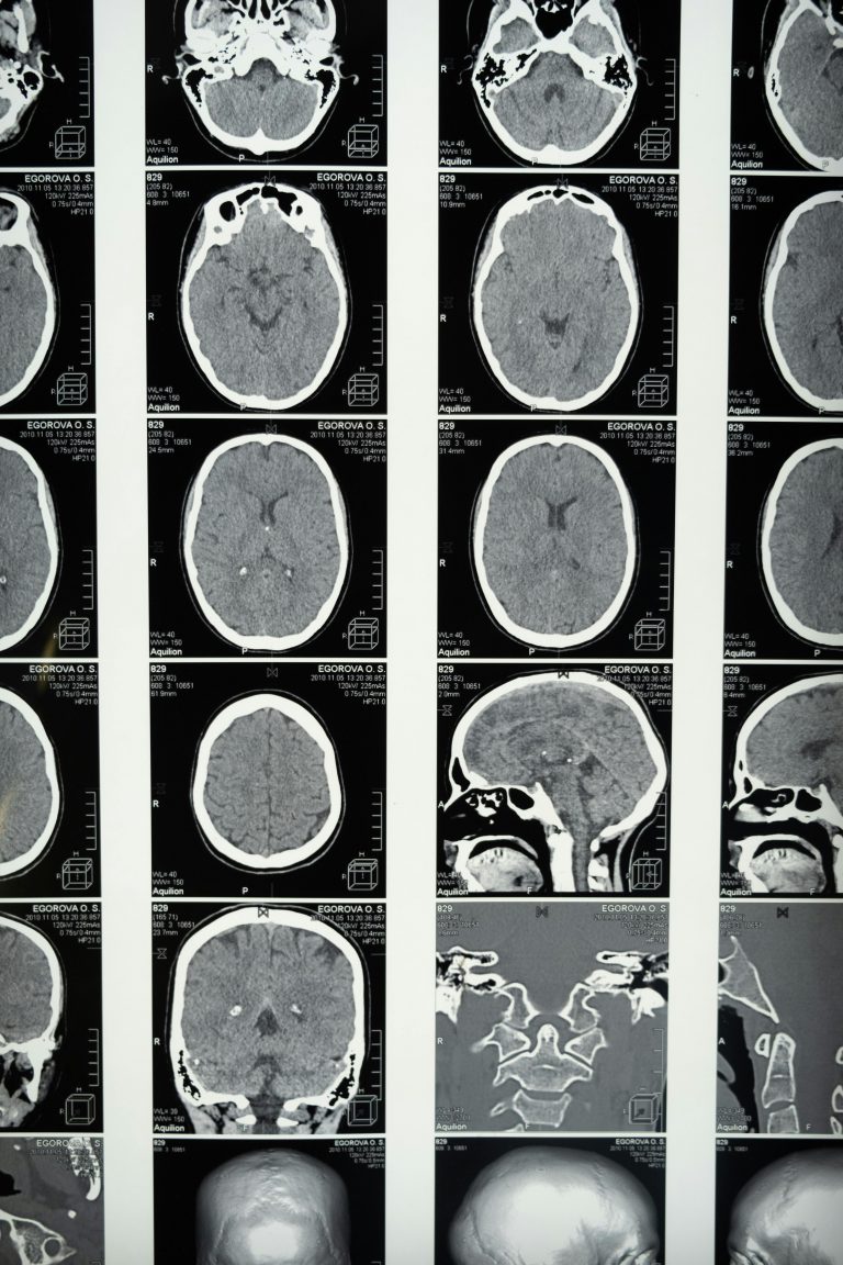 Gehirn MRT CT Radiologie